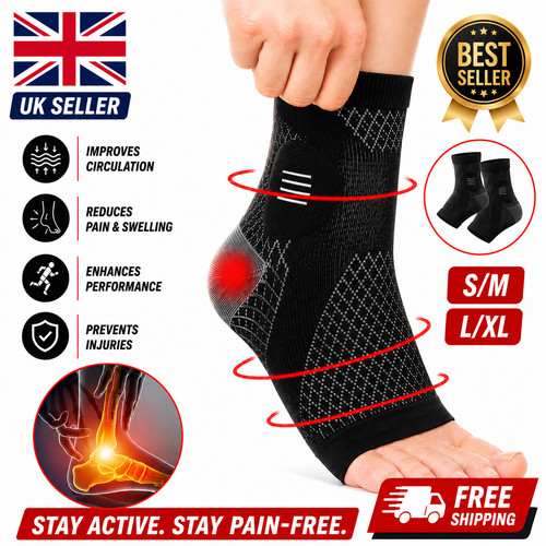 Plantar fasciitis - x,